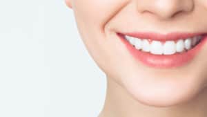 אישה מחייכת עם שיניים לבנות